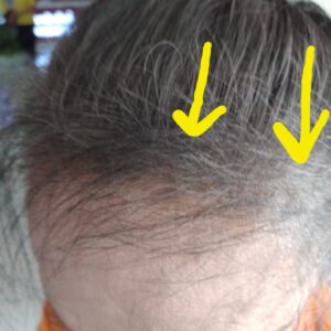 Alternative view of แชมพู LR 400ml.
